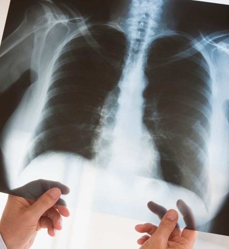Chest x-ray --- Image by © Tetra Images/Corbis