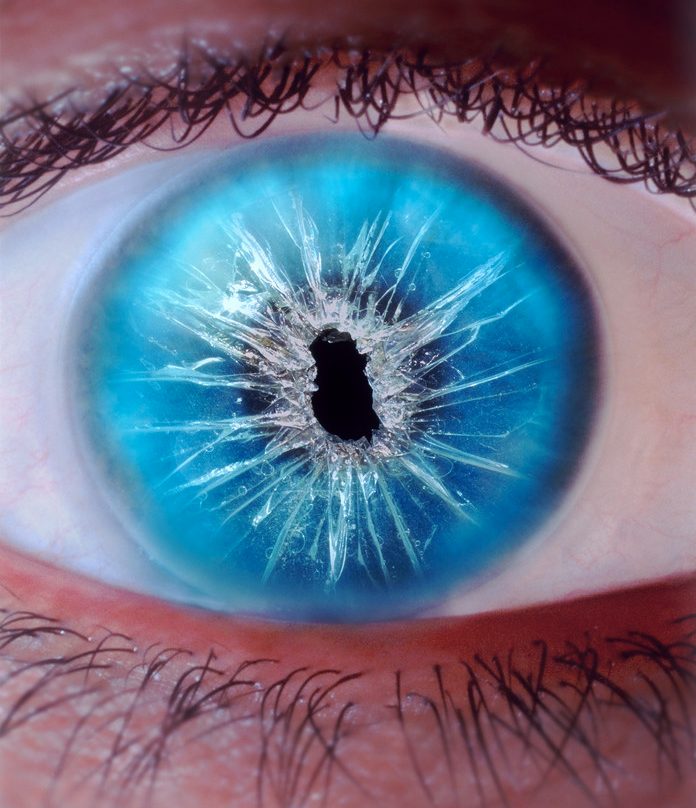 Vision problems --- Image by © Sanford/Agliolo/CORBIS