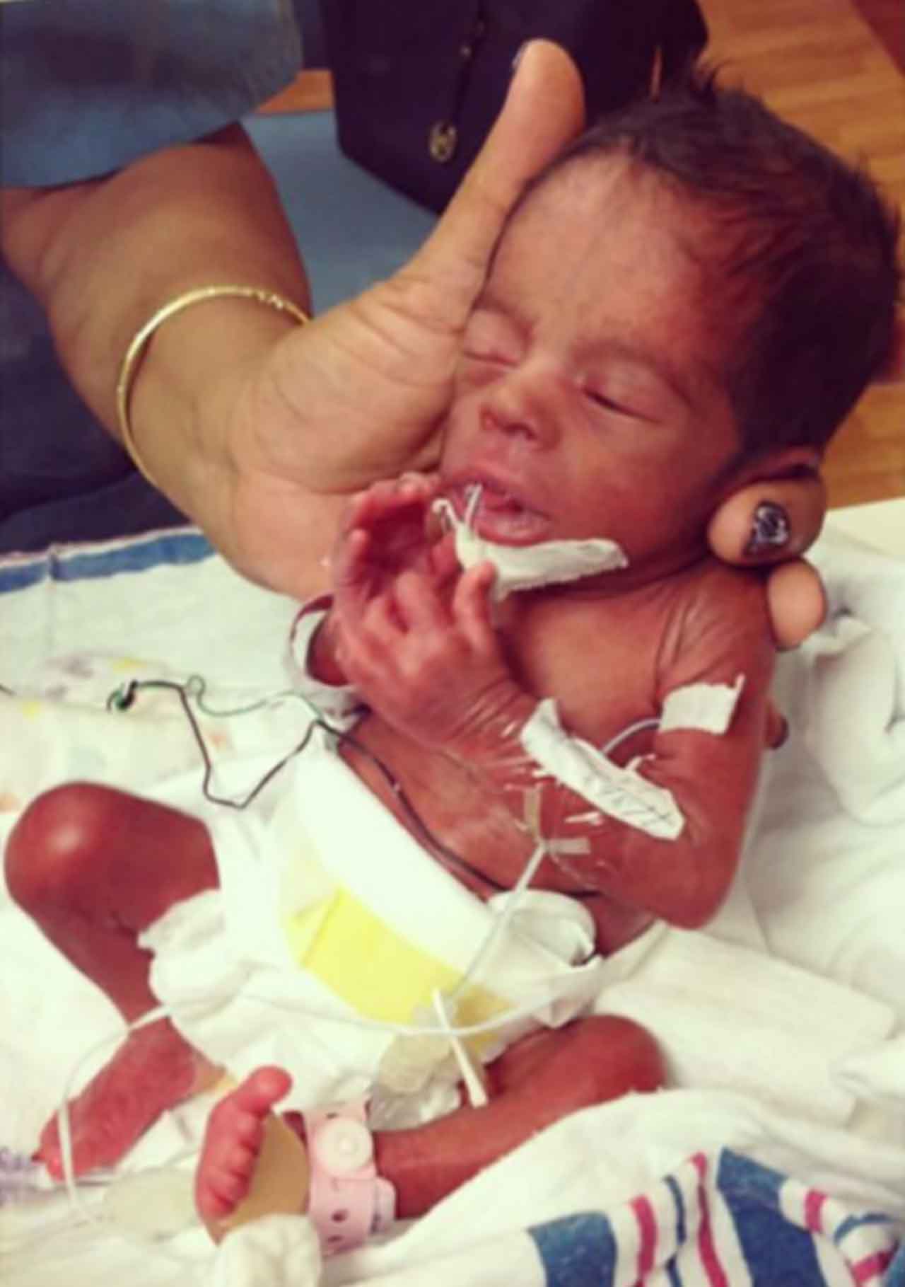 Newborn Care; Neonatal Intensive Care Unit; NICU; Newborn Complications; Newborn Complications, Behavior; Newborn Complications, Breathing; Newborn Complications, Gastrointestinal; Newborn Complications, Skin Color; Newborn, Procedures; Premature Baby; Premature Birth