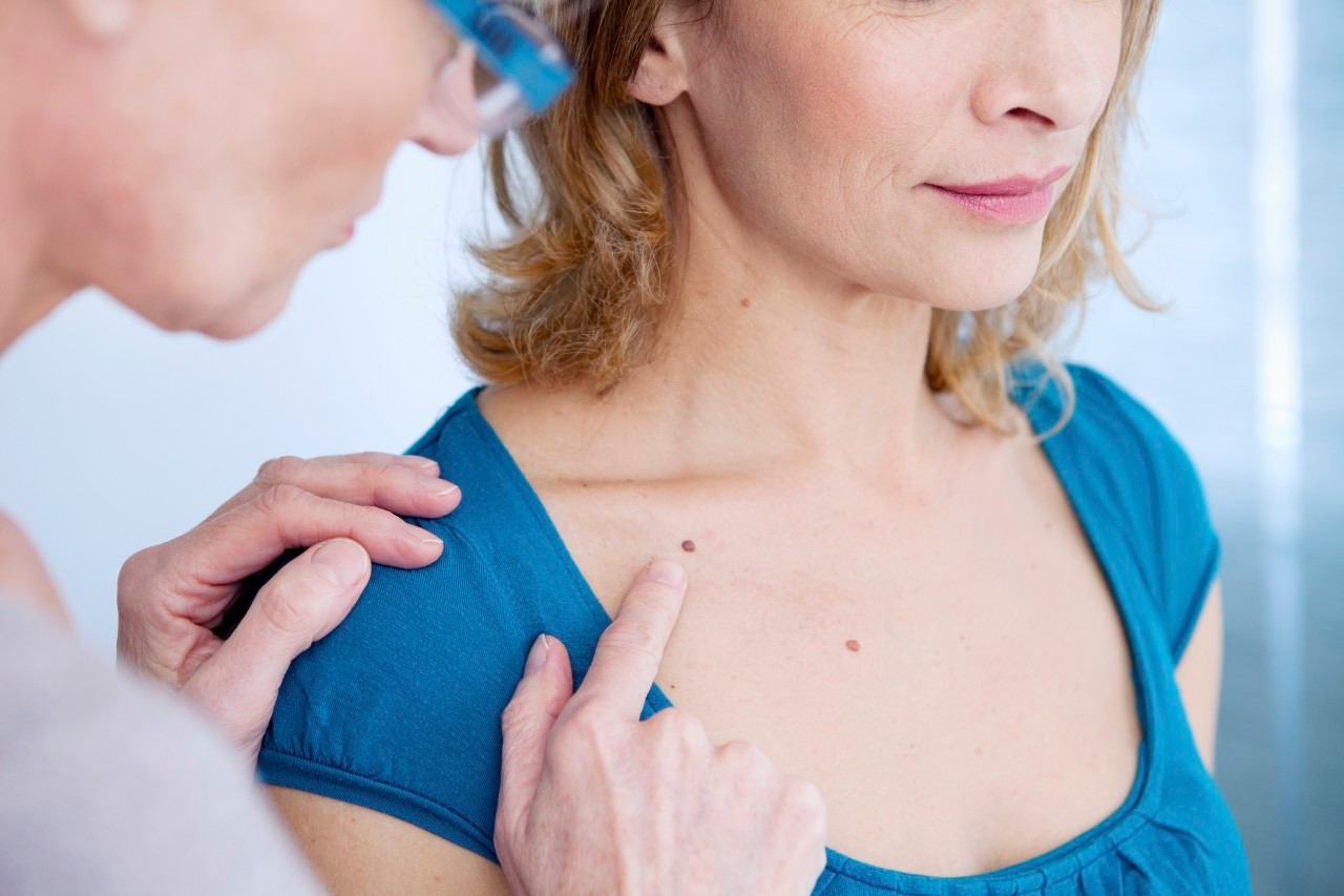 07 Mar 2014 --- Doctor examining the upper chest of a patient. --- Image by © B. BOISSONNET / BSIP/BSIP/Corbis